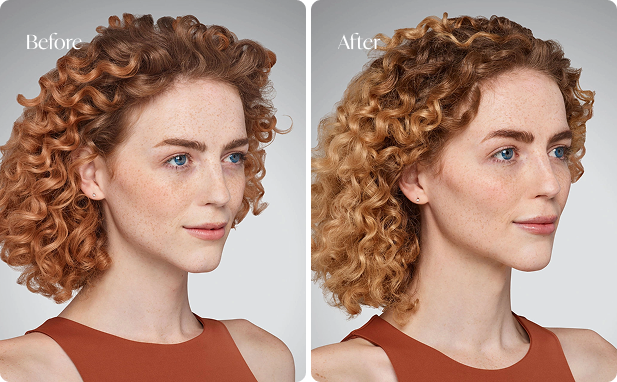 Dermal Fillers Las Vegas & Summerlin